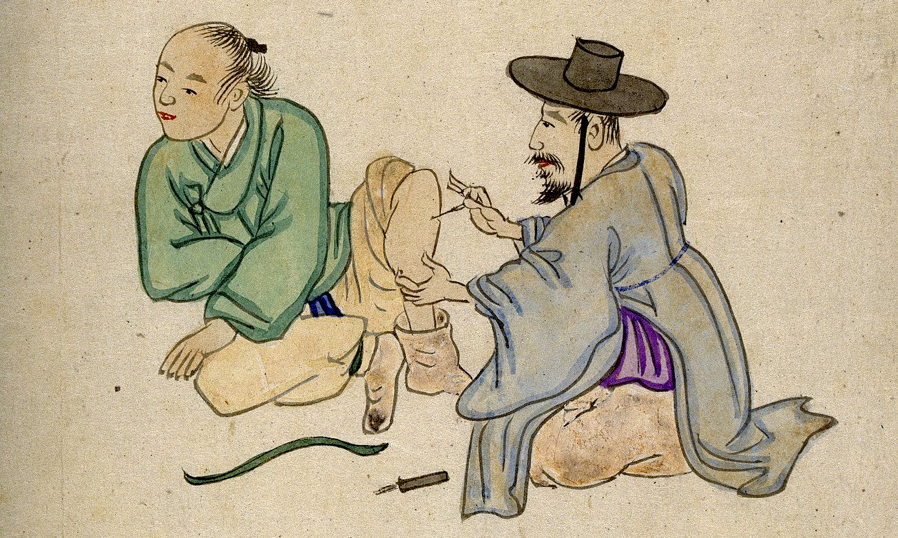 A_Korean_acupuncturist_inserting_a_needle_into_a_leg_Wellcome_V0018478_mod